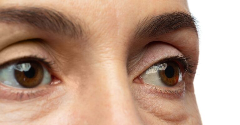 ‌Say Goodbye To Puffy Eyes