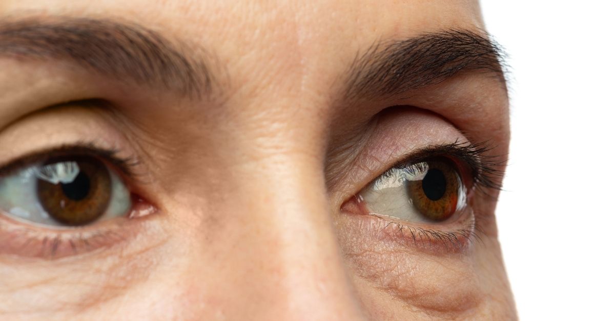 ‌Say Goodbye To Puffy Eyes